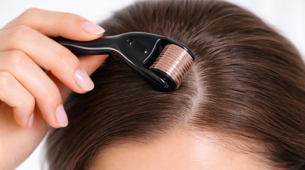 Dermaroller for Hair Growth: A Personal Journey to Thicker Fuller Hair