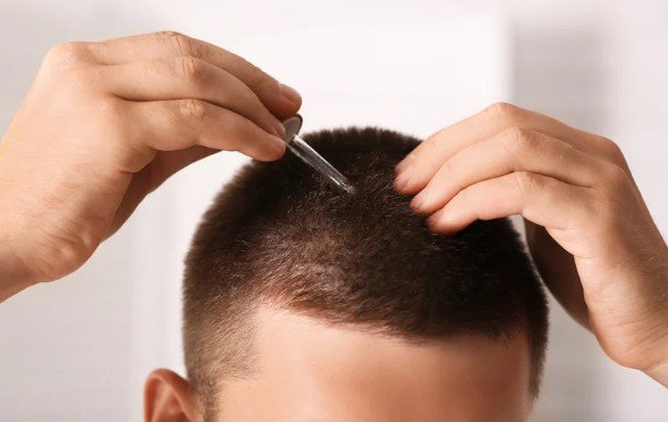 How Do I Choose the Right Hair Growth Serum for My Type of Hair Loss