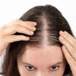 Why Is My Hair Thinning