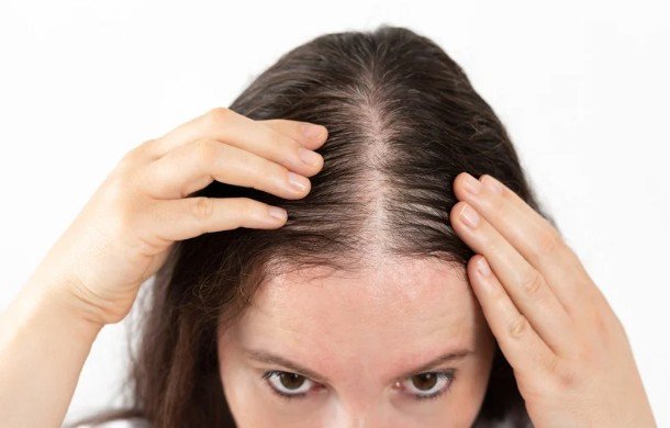 Why Is My Hair Thinning? Discover the Causes and Effective Solutions